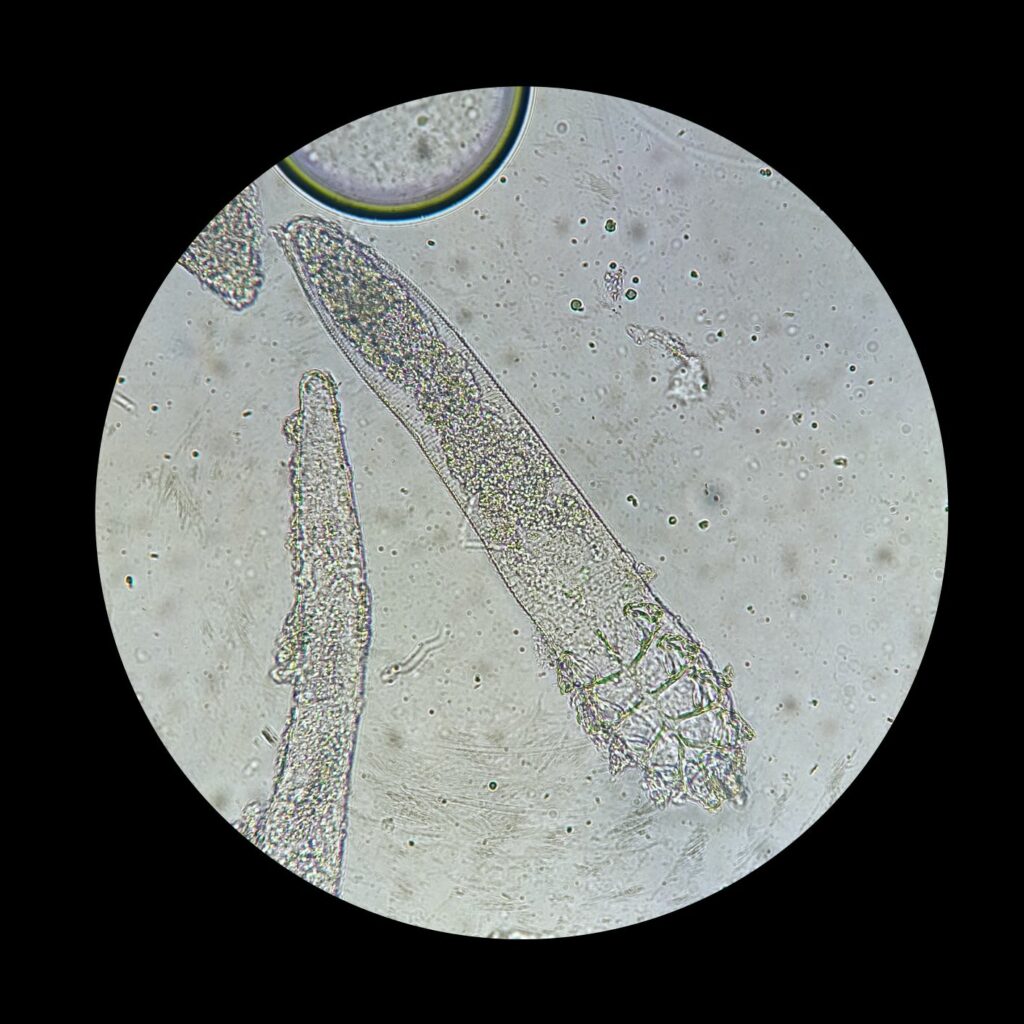 Roztoče demodex pod mikroskopom