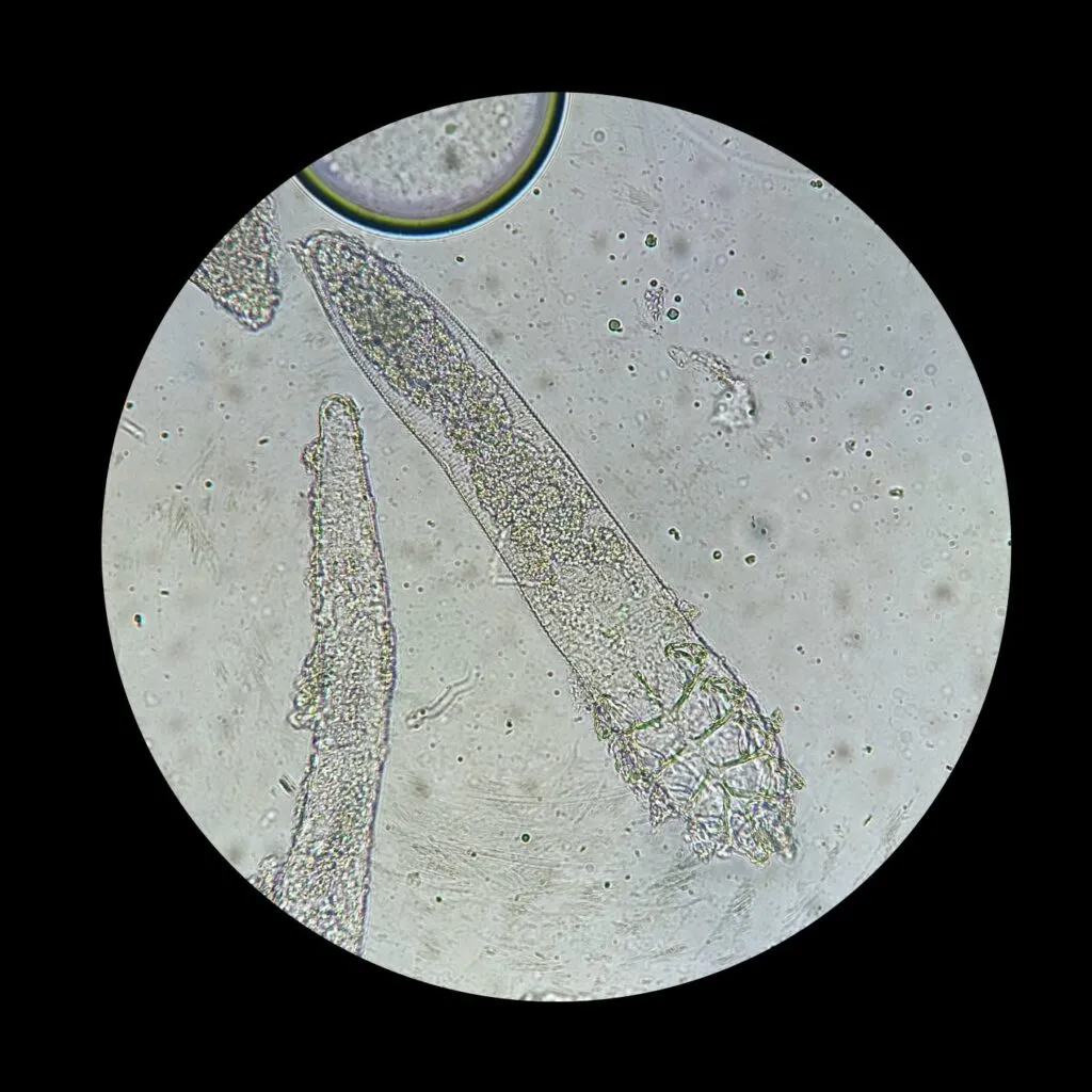 Roztoče demodex pod mikroskopom